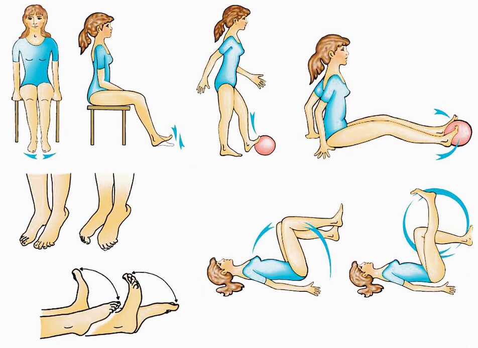 Exercícios físicos para varizes